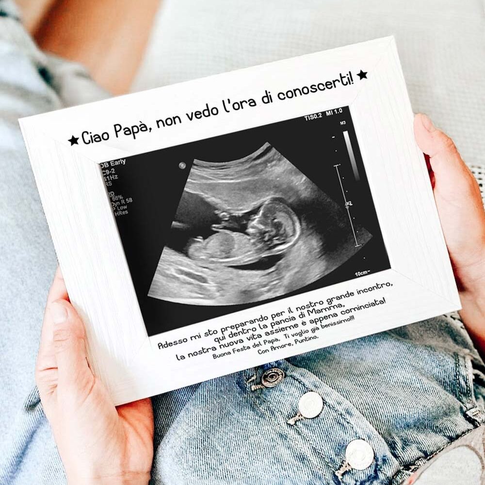 Cornice Ecografia Papa Non Vedo Ora Conoscerti Festa Papa 2025